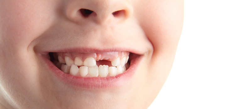 children losing baby teeth age