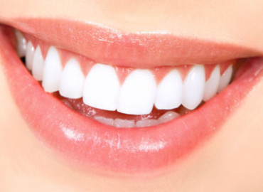 healthy-smile-teeth