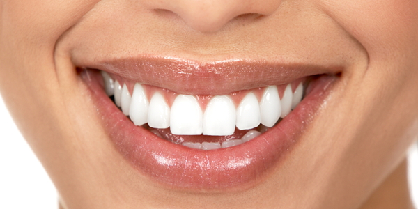 teeth-whitening