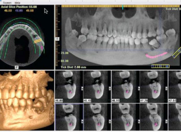 CBCT 2