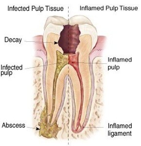 tooth anatomy